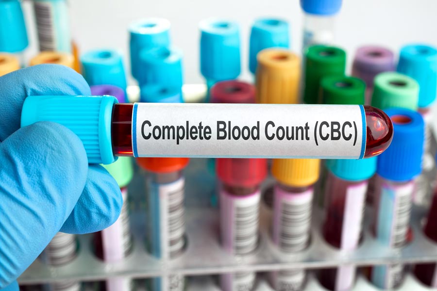 You are currently viewing Unlocking the Mystery: What CBC Blood Tests Reveal About Cancer?