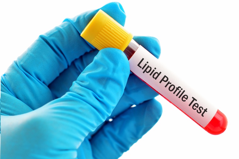 You are currently viewing Unlocking the Secrets of Your Health: What Does a Lipid Panel Test Reveal?