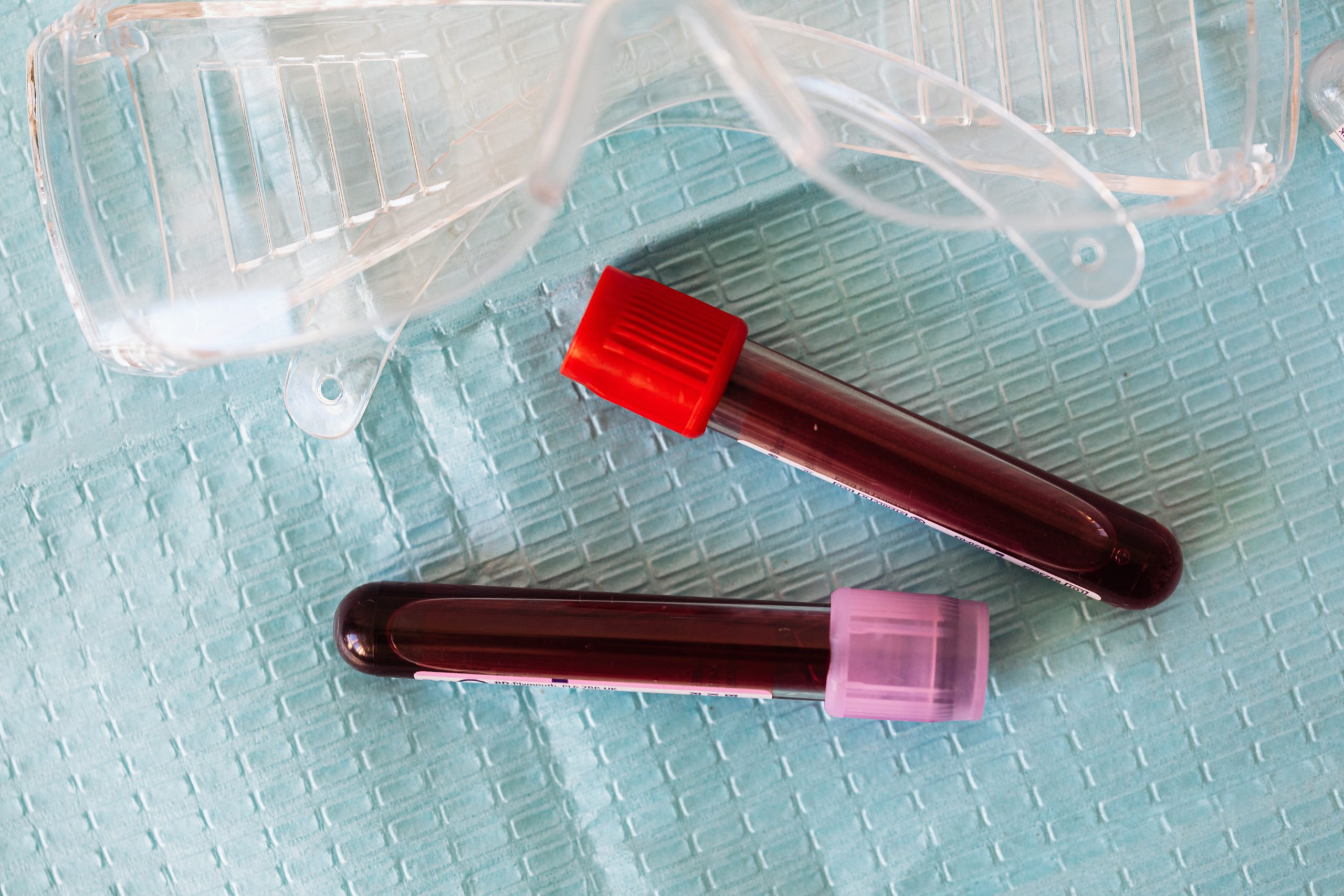 You are currently viewing What Is a CMP Blood Test?