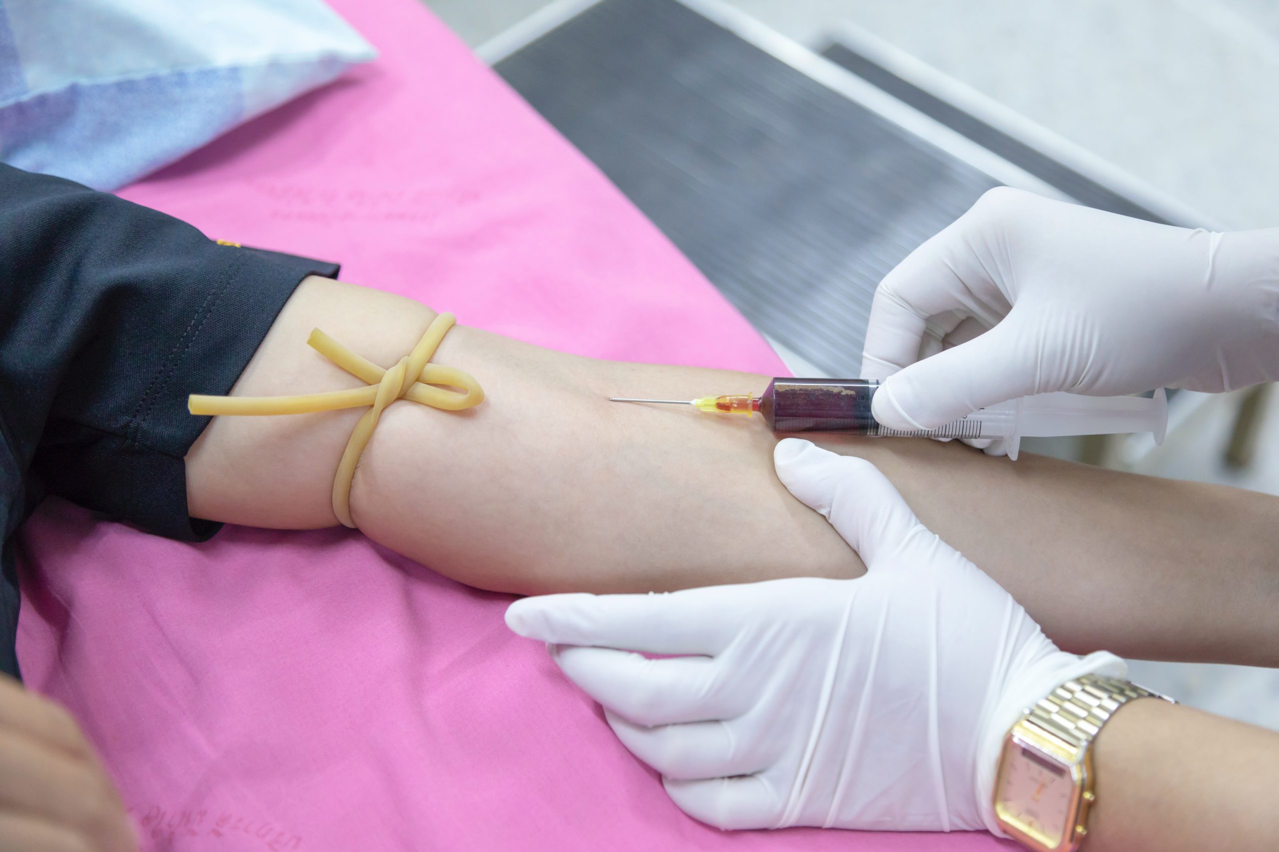 Read more about the article Unlocking the Mystery: What Is Venipuncture and Why You Need to Know!